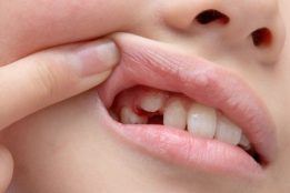 Japanese world's first tooth-regenerating drug set for human testing