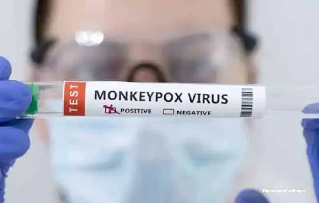 India reports suspected mpox case in Delhi