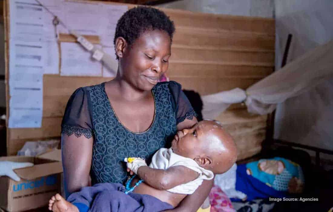 UNICEF seeks US$58.8 million to address rising mpox cases