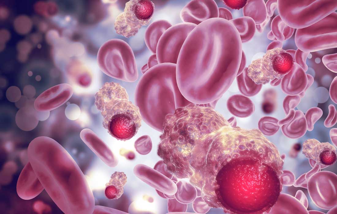 Cholesterol-lowering statins may boost blood cancer survival: UAE study