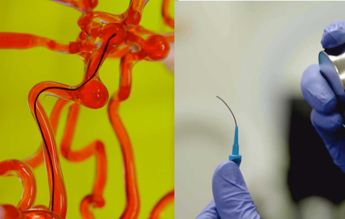 MIT’s brain-thread robot could make stroke surgery safer