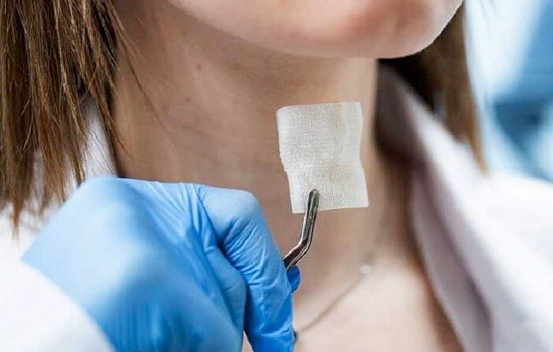 Russian scientists unveil 3D-printed laryngeal implant