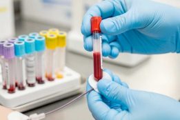 Indian woman’s rare CRIB blood group discovery stuns global medical experts