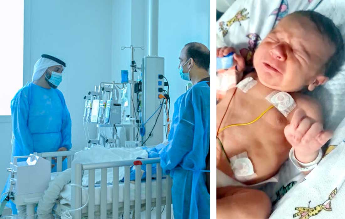 UAE’s youngest liver transplant saves baby’s life
