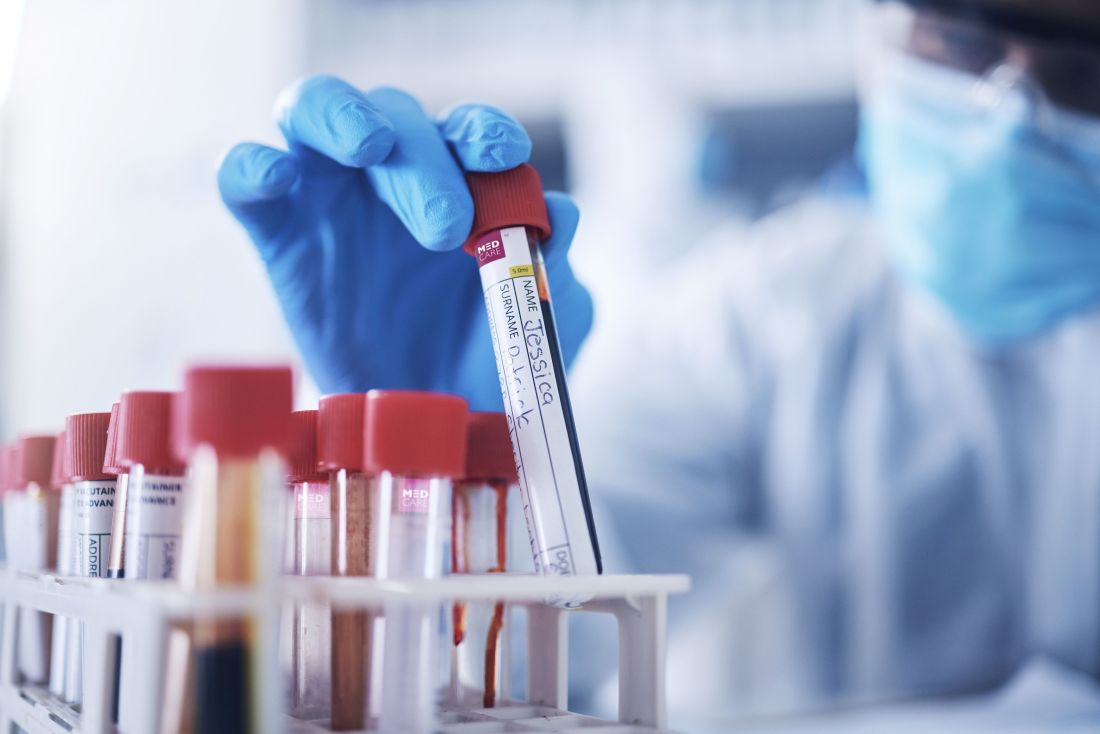 AI blood test to detect heart disease before symptoms start