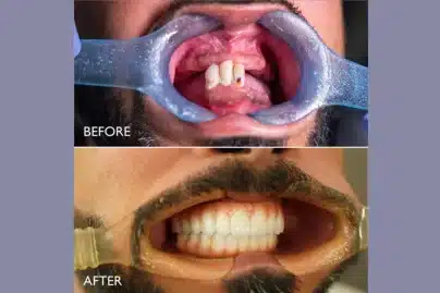 Emirati patient regains confidence after jaw reconstruction surgery in Dubai