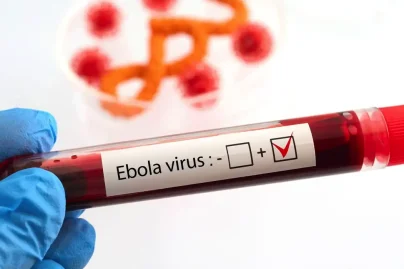 France’s first Ebola patient recovers after treatment following Congo humanitarian mission