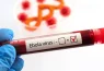 France’s first Ebola patient recovers after treatment following Congo humanitarian mission