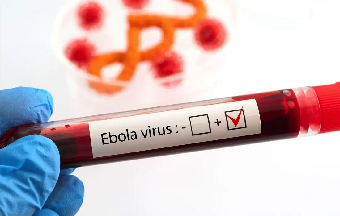 First Ebola patient recovers in France