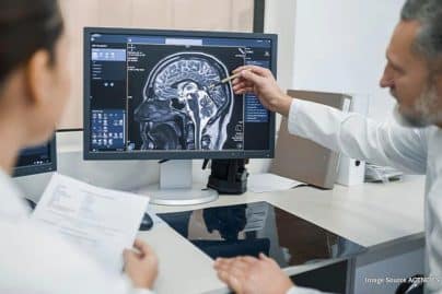 Alzheimer’s research shifts towards prevention as earlier treatment shows promise