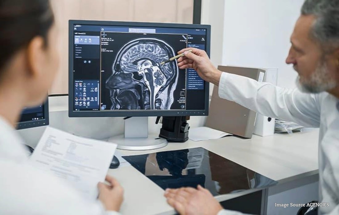 Neurologist reviewing a brain scan as researchers explore earlier detection and treatment of Alzheimer’s disease.
