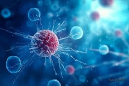 New MRI contrast agent could detect tiny lung tumours earlier