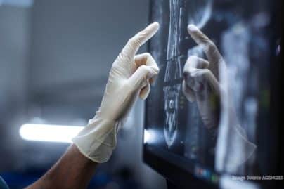 India healthcare AI faces integration hurdle as hospitals move beyond pilots