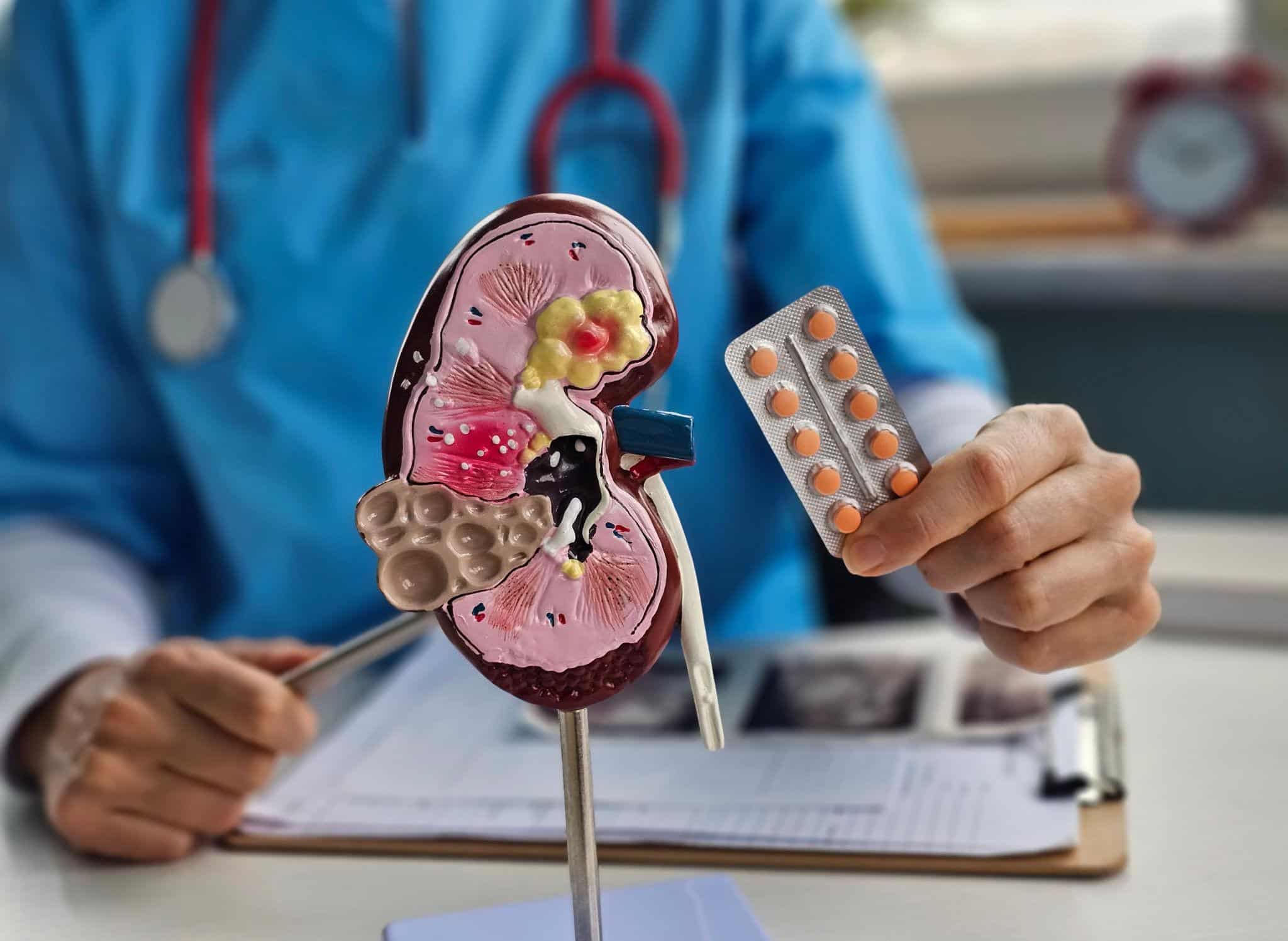 Kidney anatomical model with painkiller tablets illustrating the risks of prolonged self-medication